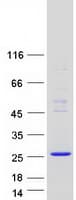 Human THEM6 / C8orf55 Protein (Recombinant Myc-DDK (Flag))