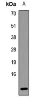 HBXIP Antibody