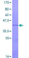 Human UCP3 Protein (Recombinant GST)