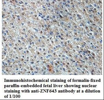 ZNF643 Antibody (aa56-308)