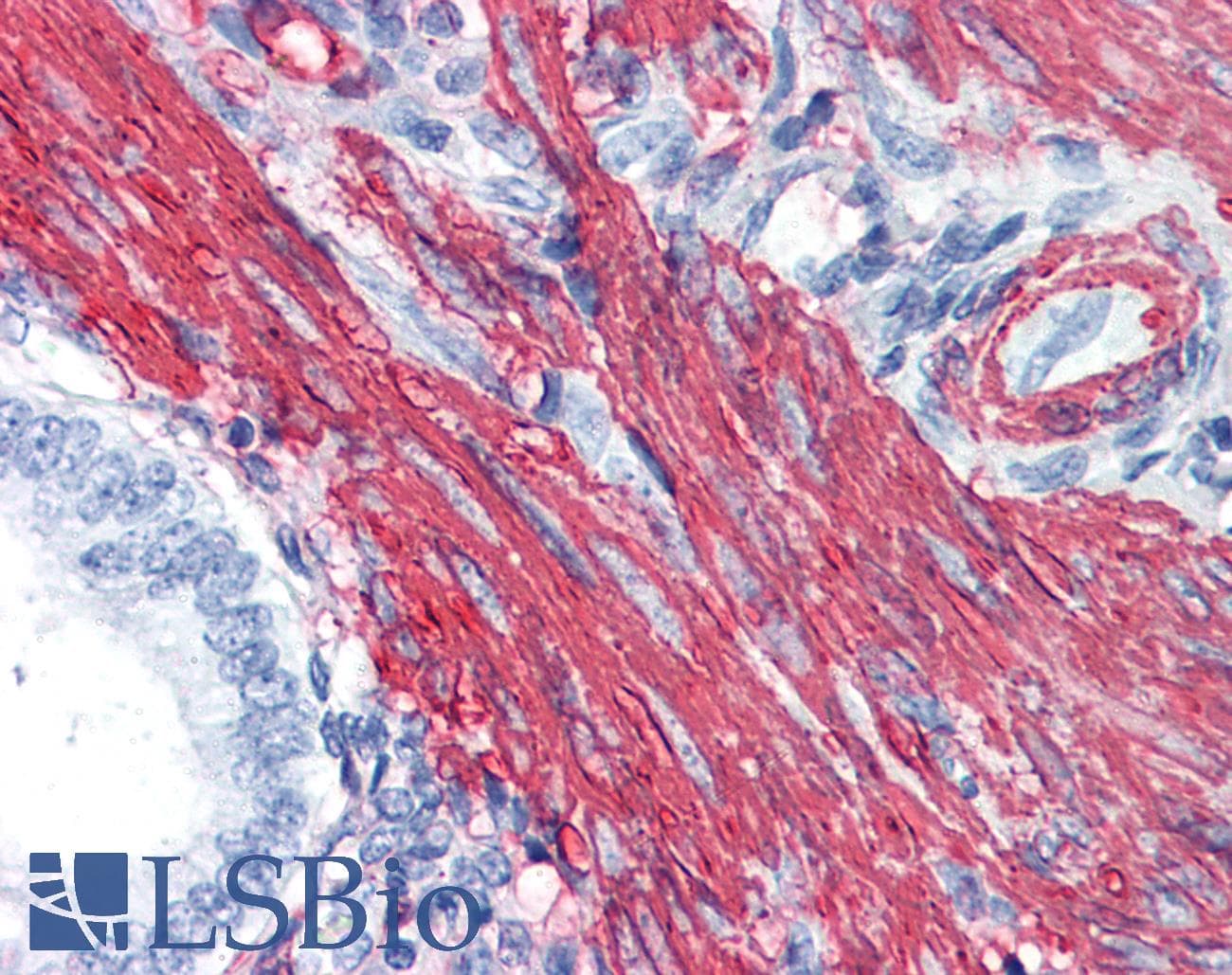 IHC-plus™ ACTA2 / Smooth Muscle Actin Antibody (clone 1D11-2B9)