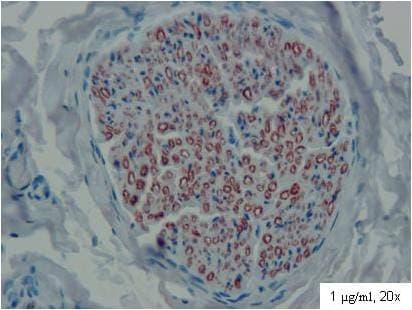 PMP22 Antibody (Extracellular Domain, clone CF1)