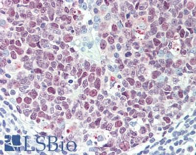 IHC-plus™ PCNA Antibody