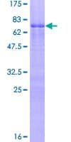 Human ZNF276 Protein (Recombinant GST)