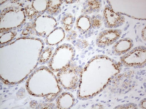 ZNF217 Antibody (aa730-1048, clone OTI2B1)