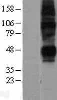 SLC29A2 / ENT2 Protein (Over-Expression Lysate Myc-DDK (Flag))