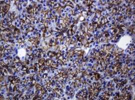 Monoclonal Mouse anti-Human CDH1 / E Cadherin Antibody (clone OTI2F9, IHC, WB)