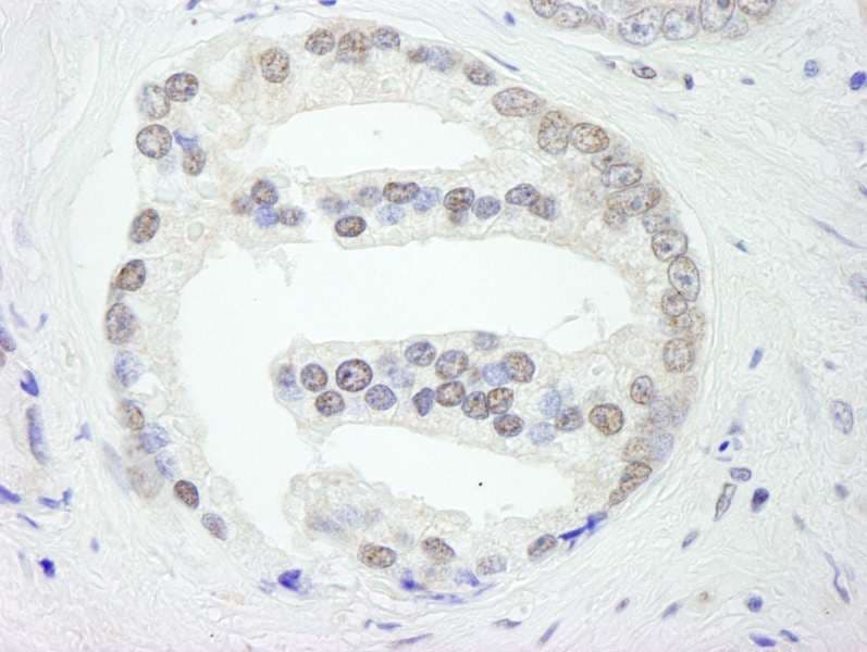 PRPF19 / PRP19 Antibody (aa25-75)