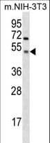 GSK3A / GSK3 Alpha Antibody (aa348-376)
