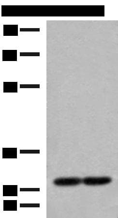 Polyclonal Rabbit anti-Human MRPS18B Antibody (IHC, WB)