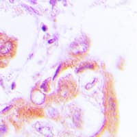 PRKAB1 / AMPK Beta 1 Antibody (phospho-Ser182)