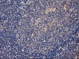 HDAC6 Antibody (clone OTI3E7)