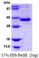 Human ITLN1 / Omentin Protein (Recombinant)