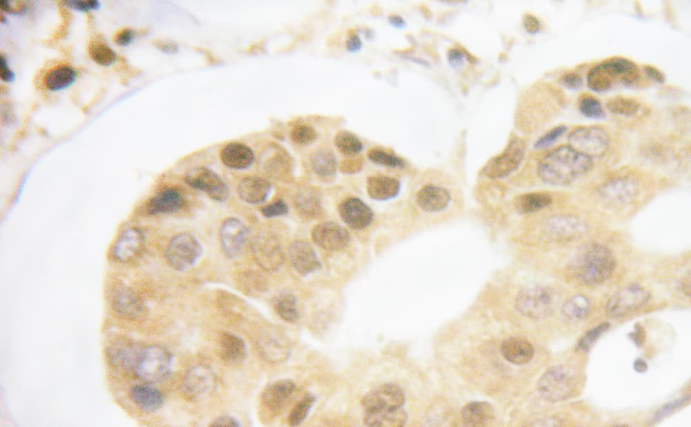 LMNA / Lamin A+C Antibody (phospho-Ser392)