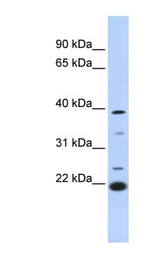 Polyclonal Rabbit anti-Human PEF1 Antibody (aa180-229, WB)