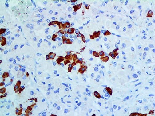 GH / Growth Hormone Antibody