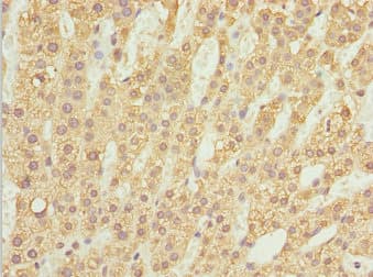 ZBTB20 Antibody
