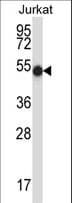 PNKP Antibody (aa109-138)