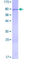 Human IFIT1 / ISG56 Protein (Recombinant GST)