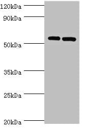 PNPLA2 / ATGL Antibody (aa265-504)