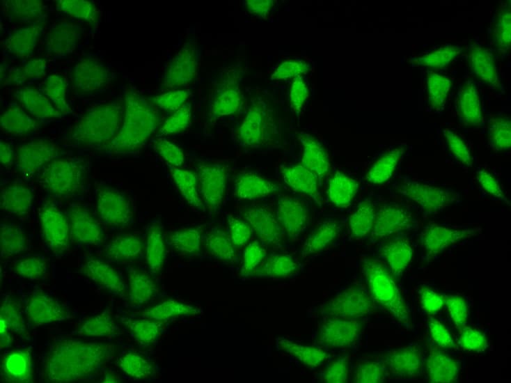 CETN2 / Centrin 2 Antibody