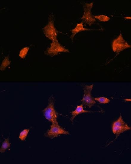 Tuberin / TSC2 Antibody