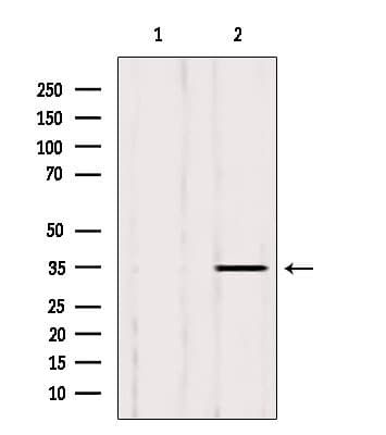 LDHB / Lactate Dehydrogenase B Antibody
