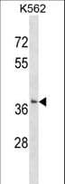 Polyclonal Rabbit anti-Human SMUG1 Antibody (aa43-71, WB)