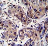 MAGEA3 Antibody (aa283-314)