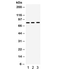 Polyclonal Rabbit anti-Mouse MMP9 / Gelatinase B Antibody (IHC, WB)