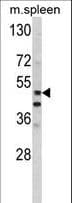 Polyclonal Rabbit anti-Human MMP10 Antibody (aa394-423, IHC, WB)