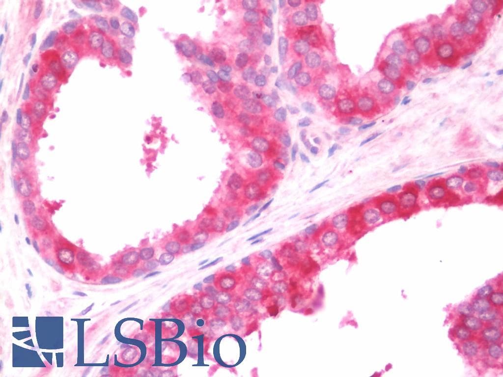 IHC-plus™ Polyclonal Rabbit anti-Human COL4A3BP / CERT Antibody (N-Terminus, IHC, WB)