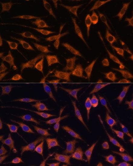Polyclonal Rabbit anti-Human ACAT2 Antibody (IHC, IF)