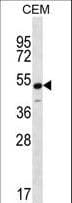 KCNJ8 / Kir6.1 Antibody (aa4-33)