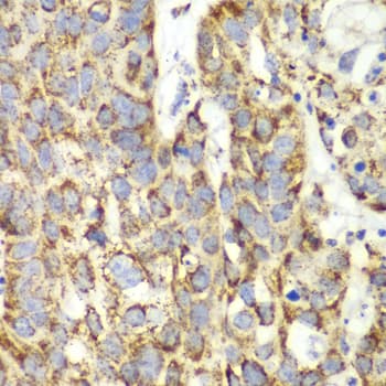 Polyclonal Rabbit anti-Human UGDH / UDPGDH Antibody (IHC, IF, WB)