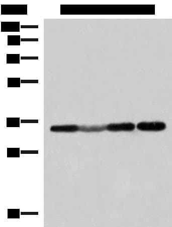 Polyclonal Rabbit anti-Human ECH1 Antibody (IHC, WB)
