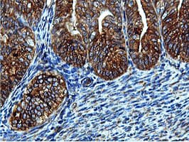 ILVBL Antibody (clone OTI8A12)
