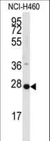 PPAP2C Antibody (aa227-254)