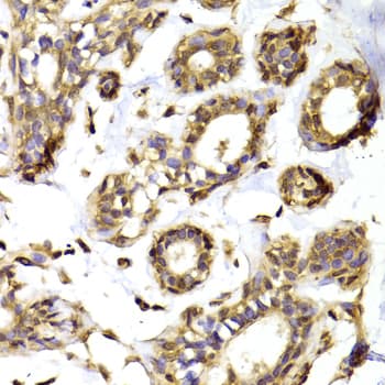 RPL13 / Ribosomal Protein L13 Antibody