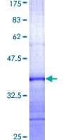 Human SUV39H1 Protein (Recombinant GST, N-terminus)