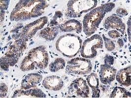 OSBP Antibody (clone OTI1F2)