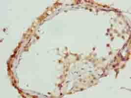 C17orf64 Antibody