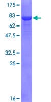 Human SCLY Protein (Recombinant GST)