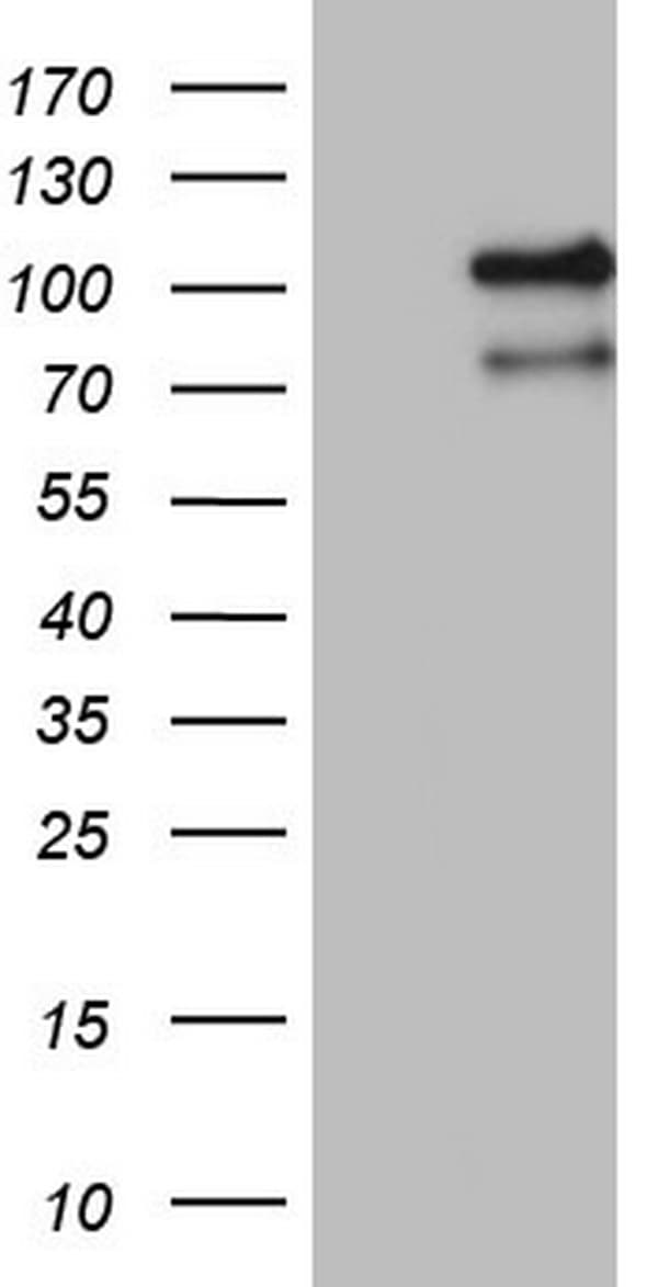 MCPH1 Antibody (aa1-264, clone OTI3C9)