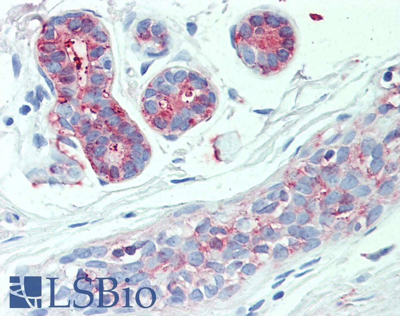 IHC-plus™ SLC4A2 / AE2 Antibody (Internal)