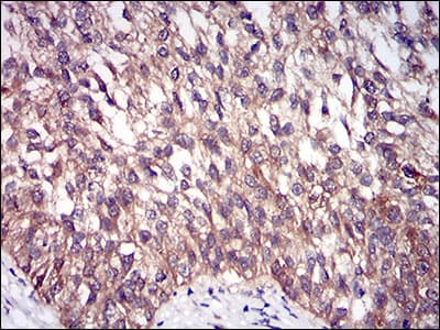 Monoclonal Mouse anti-Human DIS3L2 Antibody (clone 6C7B2, aa27-250, IHC, WB)