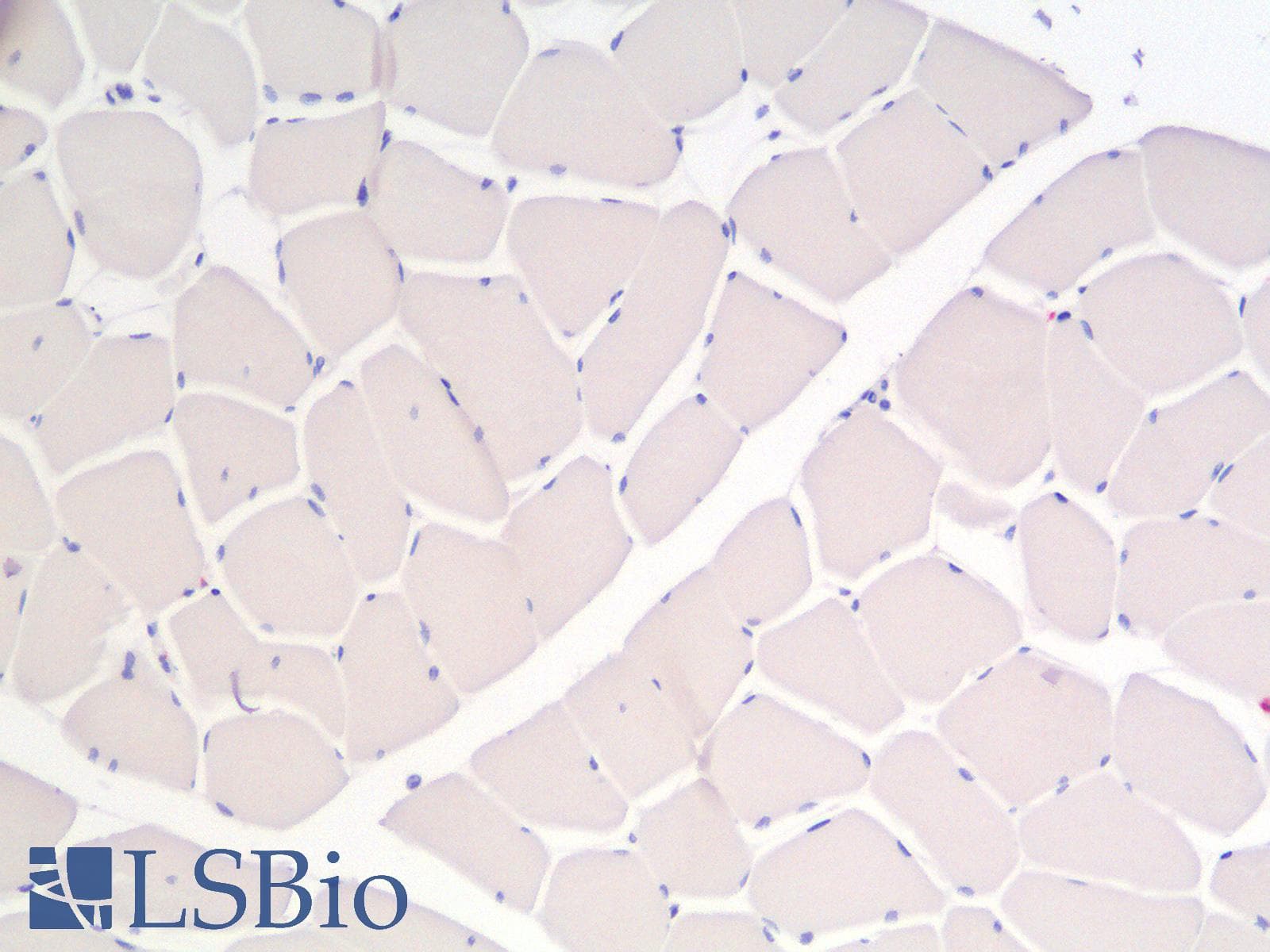 IHC-plus™ Recombinant Monoclonal Mouse anti-Human CALD1 / Caldesmon Antibody (clone rCALD1/820, IHC)