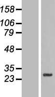 SLC39A3 / ZIP3 Protein (Over-Expression Lysate Myc-DDK (Flag))