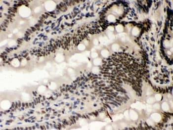 CSNK1A1 / CK1 Alpha Antibody