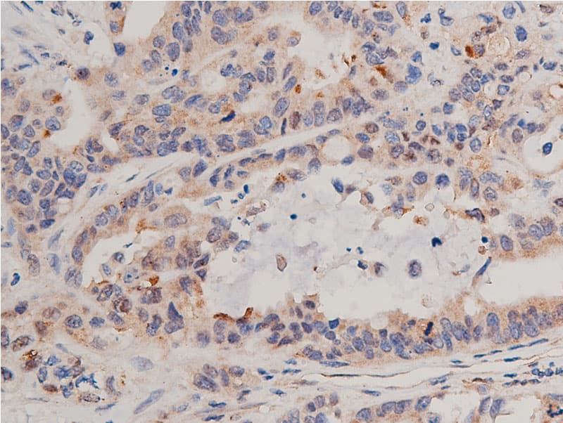 NFKBIA / IKB Alpha / IKBA Antibody